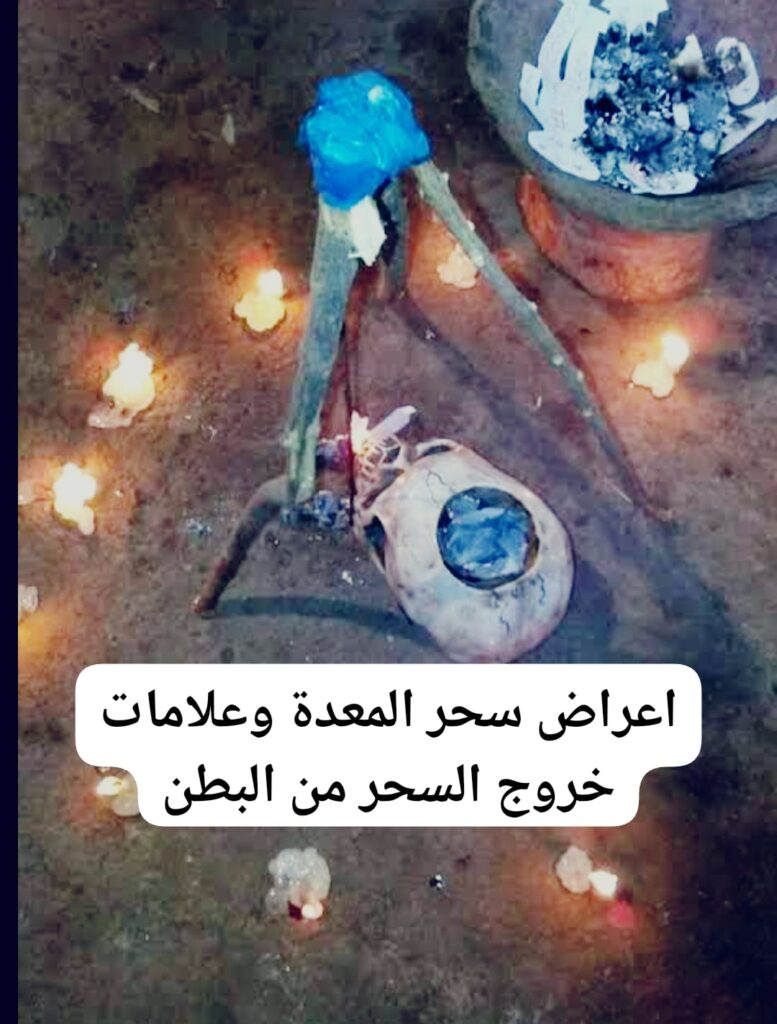 اعراض سحر المعدة وعلامات خروج السحر من البطن